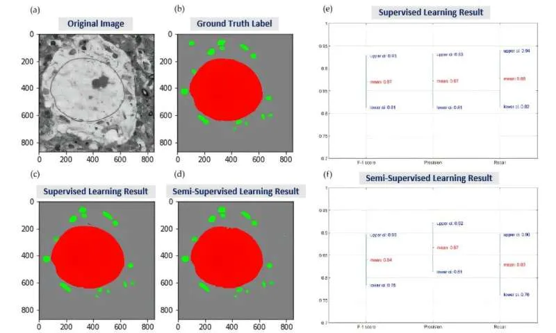 From cells to semiconductors: AI reconstructs microscopic 3D worlds from electron microscopy